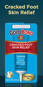 Cracked foot and heel treatment